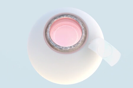 PRL手術(shù)是什么意思？